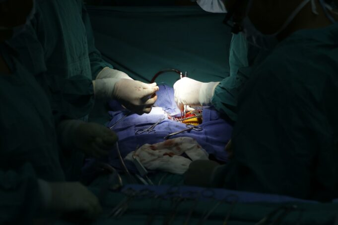 Un hígado de cerdo genéticamente modificado podría ser viable para trasplante humano Un hígado de cerdo genéticamente modificado podría ser viable para trasplante humano