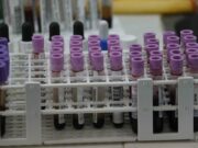 Una prueba genética de sangre identifica signos tempranos de recaída en melanoma Una prueba genética de sangre identifica signos tempranos de recaída en melanoma