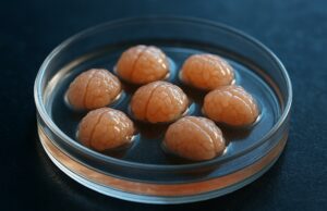 Científicos estudian Alzheimer usando tejido cerebral humano vivo en laboratorio Científicos estudian Alzheimer usando tejido cerebral humano vivo en laboratorio