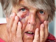 Alabama conmemora el Día Mundial contra el abuso a los adultos mayores Alabama conmemora el Día Mundial contra el abuso a los adultos mayores