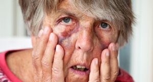 Alabama conmemora el Día Mundial contra el abuso a los adultos mayores Alabama conmemora el Día Mundial contra el abuso a los adultos mayores