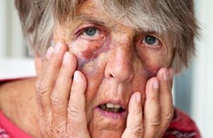 Alabama conmemora el Día Mundial contra el abuso a los adultos mayores Alabama conmemora el Día Mundial contra el abuso a los adultos mayores