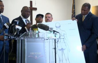 Autopsia independiente de Jabari Peoples revela posible bala faltante Autopsia independiente de Jabari Peoples revela posible bala faltante