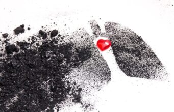 Aire considerado “seguro” puede afectar el corazón, según imágenes de resonancia Aire considerado “seguro” puede afectar el corazón, según imágenes de resonancia