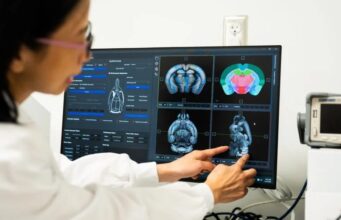 Los sorprendentes beneficios cognitivos de la creatina Los sorprendentes beneficios cognitivos de la creatina