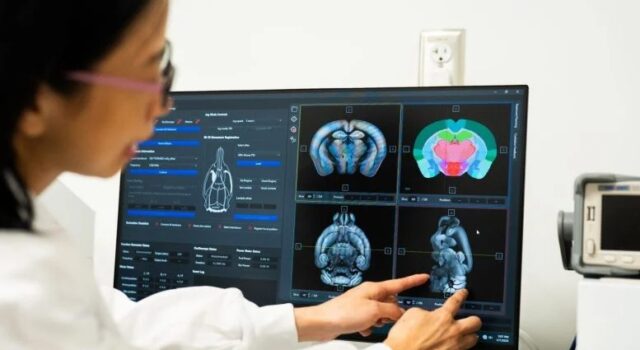 Los sorprendentes beneficios cognitivos de la creatina Los sorprendentes beneficios cognitivos de la creatina