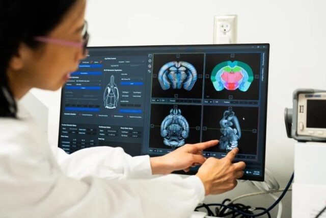 Los sorprendentes beneficios cognitivos de la creatina