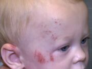 Bebé sobrevive a atropello y fuga en carrito, la policía de Jasper investiga el caso Bebé sobrevive a atropello y fuga en carrito, la policía de Jasper investiga el caso