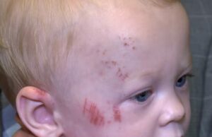 Bebé sobrevive a atropello y fuga en carrito, la policía de Jasper investiga el caso Bebé sobrevive a atropello y fuga en carrito, la policía de Jasper investiga el caso