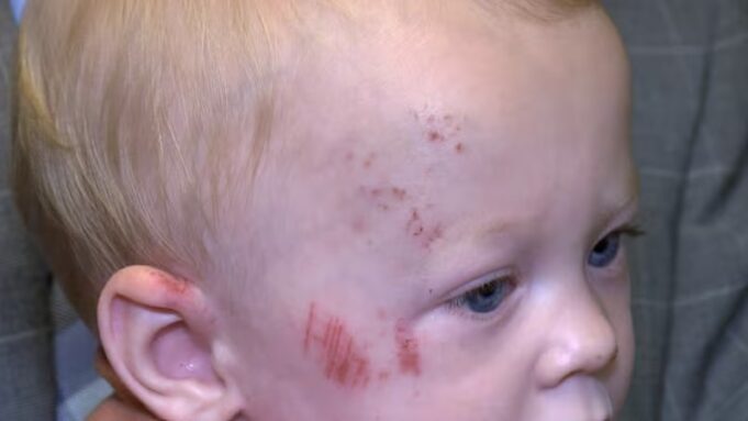 Bebé sobrevive a atropello y fuga en carrito, la policía de Jasper investiga el caso Bebé sobrevive a atropello y fuga en carrito, la policía de Jasper investiga el caso