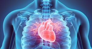 Este desconocido y mortal síndrome de salud afecta a casi el 90% de los adultos estadounidenses. ¿Podría usted tenerlo? Este desconocido y mortal síndrome de salud afecta a casi el 90% de los adultos estadounidenses. ¿Podría usted tenerlo?