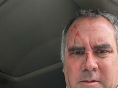 Atentado contra candidato peruano subraya profunda preocupación por la seguridad nacional Atentado contra candidato peruano subraya profunda preocupación por la seguridad nacional