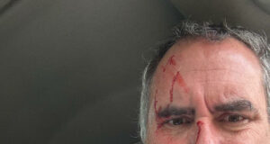 Atentado contra candidato peruano subraya profunda preocupación por la seguridad nacional Atentado contra candidato peruano subraya profunda preocupación por la seguridad nacional