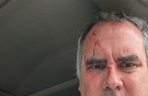 Atentado contra candidato peruano subraya profunda preocupación por la seguridad nacional Atentado contra candidato peruano subraya profunda preocupación por la seguridad nacional