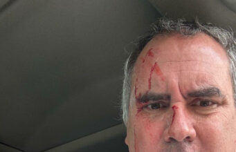 Atentado contra candidato peruano subraya profunda preocupación por la seguridad nacional Atentado contra candidato peruano subraya profunda preocupación por la seguridad nacional