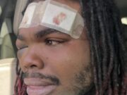 Hombre de Tuscaloosa demanda a policías por violenta parada de tráfico Hombre de Tuscaloosa demanda a policías por violenta parada de tráfico