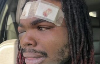 Hombre de Tuscaloosa demanda a policías por violenta parada de tráfico Hombre de Tuscaloosa demanda a policías por violenta parada de tráfico