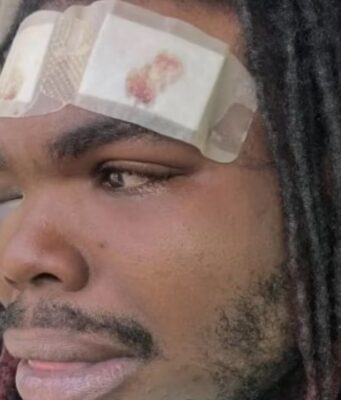 Hombre de Tuscaloosa demanda a policías por violenta parada de tráfico Hombre de Tuscaloosa demanda a policías por violenta parada de tráfico