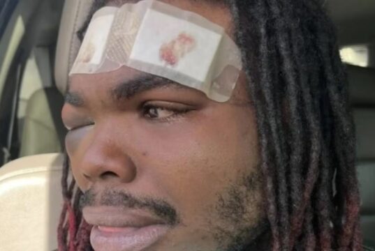 Hombre de Tuscaloosa demanda a policías por violenta parada de tráfico Hombre de Tuscaloosa demanda a policías por violenta parada de tráfico