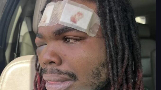 Hombre de Tuscaloosa demanda a policías por violenta parada de tráfico Hombre de Tuscaloosa demanda a policías por violenta parada de tráfico