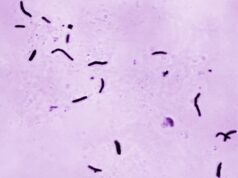 Detectado caso de tuberculosis en la escuela secundaria Grissom de Huntsville Detectado caso de tuberculosis en la escuela secundaria Grissom de Huntsville