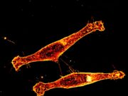Descubrimiento sobre la propagación de la proteína tóxica en la enfermedad de Huntington Descubrimiento sobre la propagación de la proteína tóxica en la enfermedad de Huntington