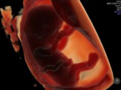 Ingesta de productos ultraprocesados perjudica la fertilidad y el crecimiento del feto Ingesta de productos ultraprocesados perjudica la fertilidad y el crecimiento del feto