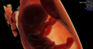 Ingesta de productos ultraprocesados perjudica la fertilidad y el crecimiento del feto Ingesta de productos ultraprocesados perjudica la fertilidad y el crecimiento del feto