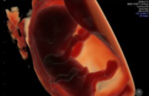 Ingesta de productos ultraprocesados perjudica la fertilidad y el crecimiento del feto Ingesta de productos ultraprocesados perjudica la fertilidad y el crecimiento del feto