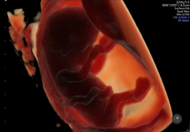 Ingesta de productos ultraprocesados perjudica la fertilidad y el crecimiento del feto