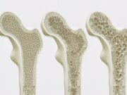 Científicos descubren receptor que fortalece huesos y revierte la osteoporosis Científicos descubren receptor que fortalece huesos y revierte la osteoporosis