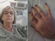Mujer de Shelby mordida por cascabel mientras cuidaba niños habla desde hospital Mujer de Shelby mordida por cascabel mientras cuidaba niños habla desde hospital