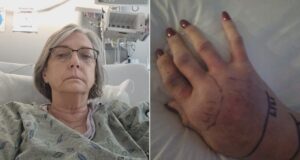 Mujer de Shelby mordida por cascabel mientras cuidaba niños habla desde hospital Mujer de Shelby mordida por cascabel mientras cuidaba niños habla desde hospital