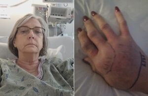 Mujer de Shelby mordida por cascabel mientras cuidaba niños habla desde hospital Mujer de Shelby mordida por cascabel mientras cuidaba niños habla desde hospital