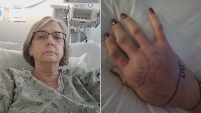 Mujer de Shelby mordida por cascabel mientras cuidaba niños habla desde hospital Mujer de Shelby mordida por cascabel mientras cuidaba niños habla desde hospital