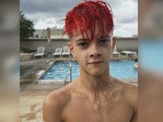 Reto de TikTok causa graves quemaduras con juguete NeeDoh Joven con cabello rojo muestra cicatrices de quemaduras en su cuello provocadas por un juguete NeeDoh.