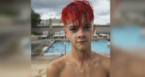 Reto de TikTok causa graves quemaduras con juguete NeeDoh Joven con cabello rojo muestra cicatrices de quemaduras en su cuello provocadas por un juguete NeeDoh.