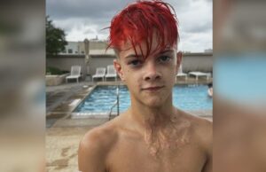 Reto de TikTok causa graves quemaduras con juguete NeeDoh Joven con cabello rojo muestra cicatrices de quemaduras en su cuello provocadas por un juguete NeeDoh.