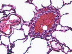 Ciclosporiasis desata alerta de viaje para mexicanos a EE. UU. Vista microscópica de una muestra celular teñida en tonos rosa y morado relacionada con la investigación de salud.
