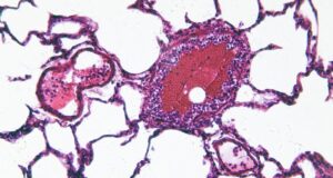 Ciclosporiasis desata alerta de viaje para mexicanos a EE. UU. Vista microscópica de una muestra celular teñida en tonos rosa y morado relacionada con la investigación de salud.