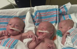 Trillizos Ivey en Huntsville celebran su primer año con salud Trillizos prematuros Ivey en la UCIN del Huntsville Hospital for Women & Children con tubos de alimentación y chupones.